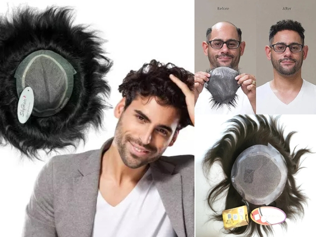 What Is Non Surgical Hair Replacement